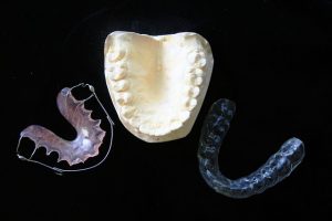 Importance of Mouth Guards