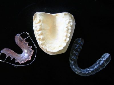 Importance of Mouth Guards