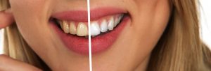 Tips for a White Bright Smile