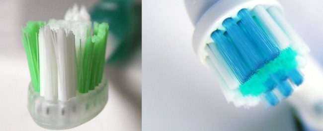 Electric vs Manual Toothbrush