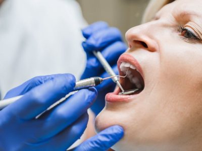 Woman with Receding Gums Check-up
