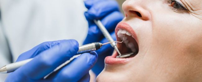 Woman with Receding Gums Check-up