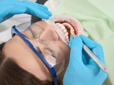 Plaque Removal at the Dentist Oakville
