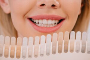 Cosmetic Dentistry Whitening for Brighter Smile