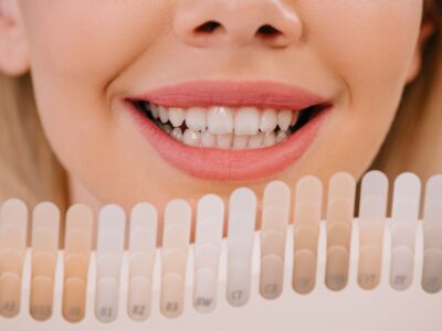 Cosmetic Dentistry Whitening for Brighter Smile