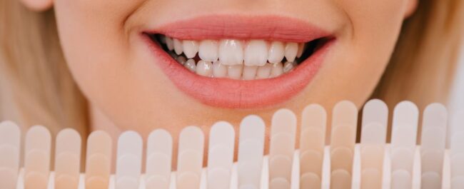 Cosmetic Dentistry Whitening for Brighter Smile